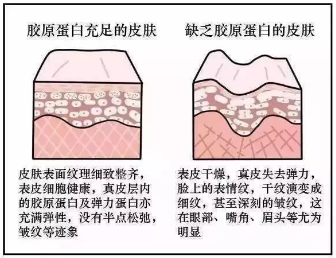 补充胶原蛋白到底有啥用？